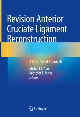 Abbildung von Alaia / Jones | Revision Anterior Cruciate Ligament Reconstruction | 1. Auflage | 2022 | beck-shop.de