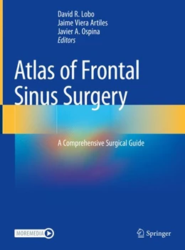 Abbildung von Lobo / Artiles | Atlas of Frontal Sinus Surgery | 1. Auflage | 2022 | beck-shop.de