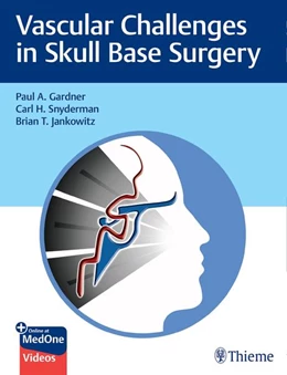 Abbildung von Gardner / Snyderman | Vascular Challenges in Skull Base Surgery | 1. Auflage | 2021 | beck-shop.de