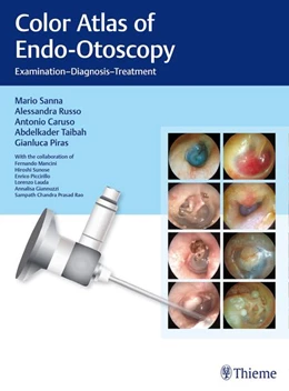 Abbildung von Sanna / Russo | Color Atlas of Endo-Otoscopy | 1. Auflage | 2017 | beck-shop.de