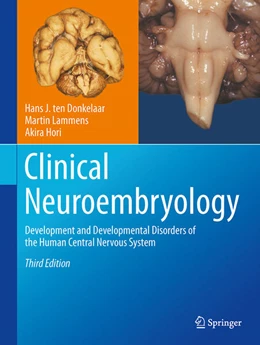 Abbildung von Ten Donkelaar / Lammens | Clinical Neuroembryology | 3. Auflage | 2023 | beck-shop.de