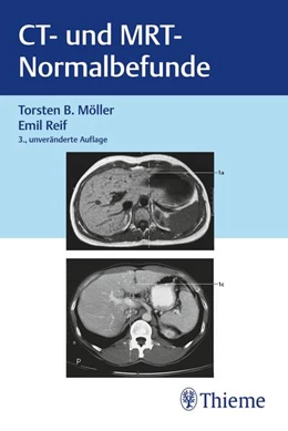 Abbildung von Möller / Reif | CT und MRT Normalbefunde | 3. Auflage | 2023 | beck-shop.de