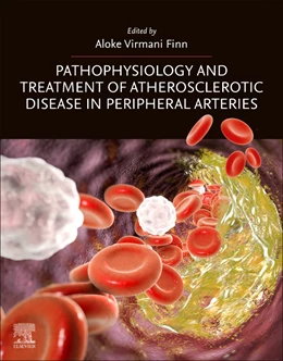 Abbildung von Finn | Pathophysiology and Treatment of Atherosclerotic Disease in Peripheral Arteries | 1. Auflage | 2024 | beck-shop.de