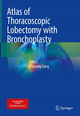 Abbildung von Li / Long | Atlas of Thoracoscopic Lobectomy with Bronchoplasty | 1. Auflage | 2024 | beck-shop.de
