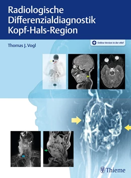Abbildung von Vogl | Radiologische Differenzialdiagnostik Kopf-Hals-Region | 1. Auflage | 2024 | beck-shop.de