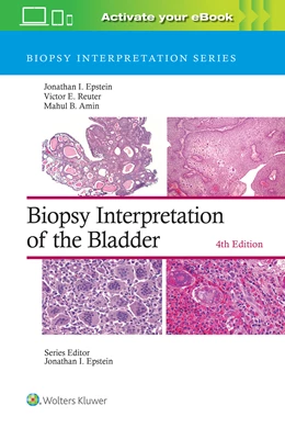 Abbildung von Epstein / Reuter | Biopsy Interpretation of the Bladder: Print + eBook with Multimedia | 4. Auflage | 2023 | beck-shop.de