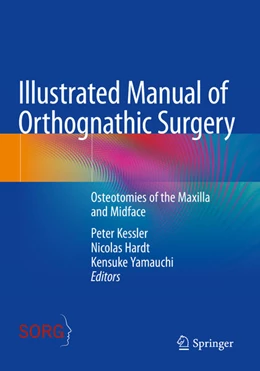 Abbildung von Kessler / Hardt | Illustrated Manual of Orthognathic Surgery | 1. Auflage | 2024 | beck-shop.de