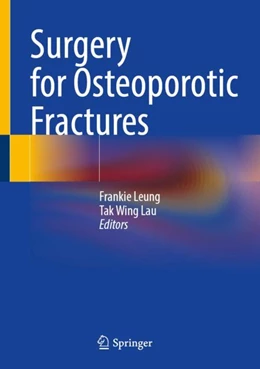 Abbildung von Leung / Lau | Surgery for Osteoporotic Fractures | 1. Auflage | 2024 | beck-shop.de