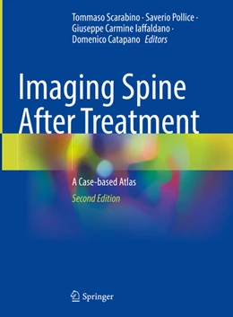 Abbildung von Scarabino / Pollice | Imaging Spine After Treatment | 2. Auflage | 2024 | beck-shop.de