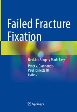 Abbildung von Giannoudis / Tornetta III | Failed Fracture Fixation | 1. Auflage | 2024 | beck-shop.de