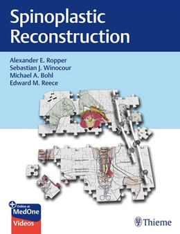Abbildung von Ropper / Winocour | Spinoplastic Reconstruction | 1. Auflage | 2024 | beck-shop.de