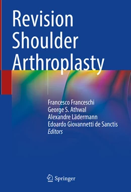 Abbildung von Franceschi / Athwal | Revision Shoulder Arthroplasty | 1. Auflage | 2024 | beck-shop.de