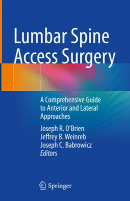 Abbildung von O'Brien / Weinreb | Lumbar Spine Access Surgery | 1. Auflage | 2024 | beck-shop.de
