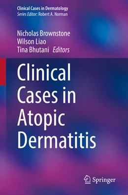 Abbildung von Brownstone / Liao | Clinical Cases in Atopic Dermatitis | 1. Auflage | 2024 | beck-shop.de