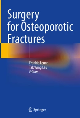 Abbildung von Leung / Lau | Surgery for Osteoporotic Fractures | 1. Auflage | 2024 | beck-shop.de