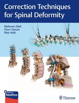 Abbildung von Zileli / Yaman | Correction Techniques for Spinal Deformity | 1. Auflage | 2024 | beck-shop.de