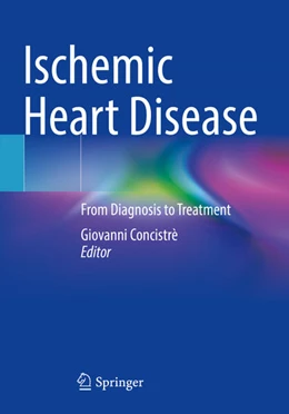 Abbildung von Concistrè | Ischemic Heart Disease | 1. Auflage | 2024 | beck-shop.de