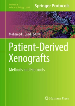 Abbildung von Saad | Patient-Derived Xenografts | 1. Auflage | 2024 | beck-shop.de