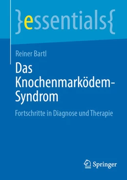 Abbildung von Bartl | Das Knochenmarködem-Syndrom | 1. Auflage | 2024 | beck-shop.de