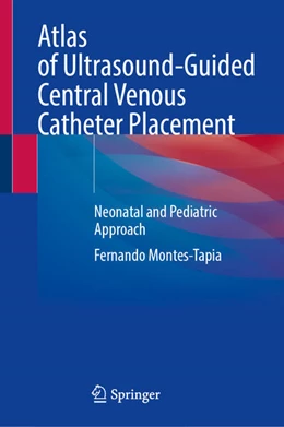 Abbildung von Montes-Tapia | Atlas of Ultrasound-Guided Central Venous Catheter Placement | 1. Auflage | 2024 | beck-shop.de