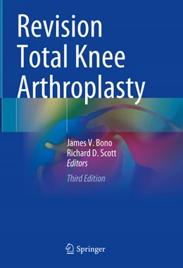 Abbildung von Bono / Scott | Revision Total Knee Arthroplasty | 3. Auflage | 2024 | beck-shop.de