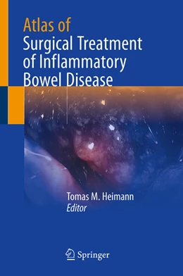 Abbildung von Heimann | Atlas of Surgical Treatment of Inflammatory Bowel Disease | 1. Auflage | 2024 | beck-shop.de