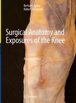 Abbildung von Zarins / Smigielski | Surgical Anatomy and Exposures of the Knee | 1. Auflage | 2024 | beck-shop.de