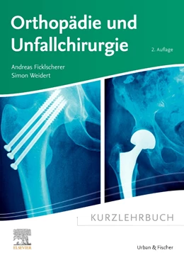 Abbildung von Ficklscherer / Weidert | Kurzlehrbuch Orthopädie und Unfallchirurgie | 2. Auflage | 2024 | beck-shop.de