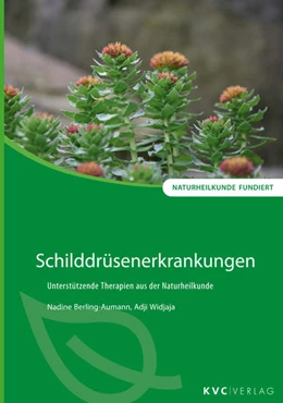 Abbildung von Berling-Aumann / Widjaja | Schilddrüsenerkrankungen | 1. Auflage | 2020 | beck-shop.de