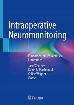 Abbildung von Zentner / Macdonald | Intraoperative Neuromonitoring | 1. Auflage | 2024 | beck-shop.de