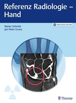 Abbildung von Schmitt / Grunz | Referenz Radiologie - Hand | 1. Auflage | 2024 | beck-shop.de