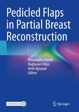 Abbildung von Hamdi / Agrawal | Pedicled Flaps in Partial Breast Reconstruction | 1. Auflage | 2024 | beck-shop.de
