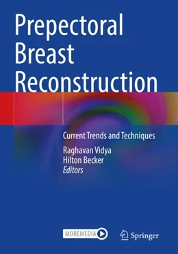Abbildung von Becker / Vidya | Prepectoral Breast Reconstruction | 1. Auflage | 2024 | beck-shop.de