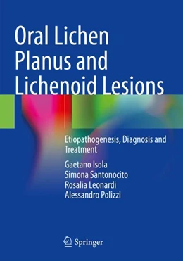 Abbildung von Isola / Santonocito | Oral Lichen Planus and Lichenoid Lesions | 1. Auflage | 2024 | beck-shop.de