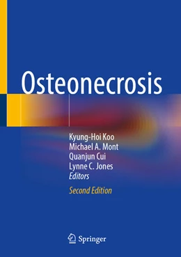Abbildung von Koo / Mont | Osteonecrosis | 2. Auflage | 2024 | beck-shop.de