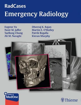 Abbildung von Yu / Jaffer | Radcases Emergency Radiology | 1. Auflage | 2015 | beck-shop.de