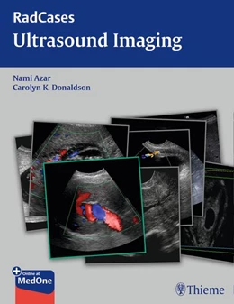 Abbildung von Azar / Donaldson | Radcases Ultrasound Imaging | 1. Auflage | 2015 | beck-shop.de