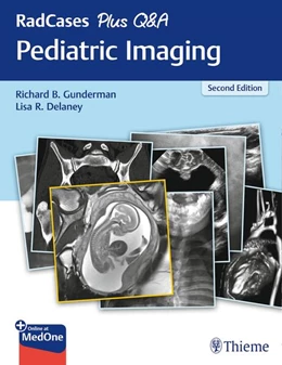 Abbildung von Gunderman / Delaney | RadCases Plus Q&A Pediatric Imaging | 2. Auflage | 2019 | beck-shop.de