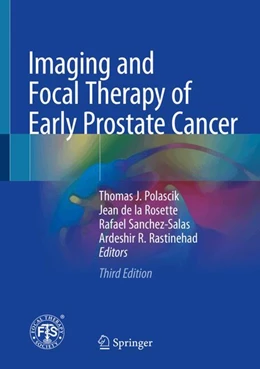 Abbildung von Polascik / de la Rosette | Imaging and Focal Therapy of Early Prostate Cancer | 3. Auflage | 2025 | beck-shop.de