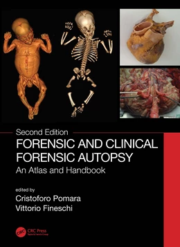 Abbildung von Pomara / Fineschi | Forensic and Clinical Forensic Autopsy | 1. Auflage | 2024 | beck-shop.de