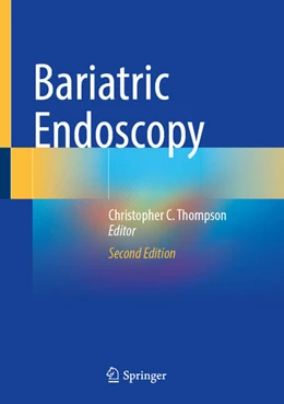 Abbildung von Thompson | Bariatric Endoscopy | 2. Auflage | 2025 | beck-shop.de