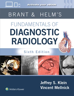 Abbildung von Klein / Mellnick | Brant & Helm's Fundamentals of Diagnostic Radiology: Print + eBook with Multimedia | 6. Auflage | 2024 | beck-shop.de