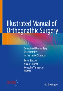 Abbildung von Kessler / Hardt | Illustrated Manual of Orthognathic Surgery | 1. Auflage | 2024 | beck-shop.de