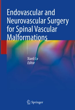 Abbildung von Lv | Endovascular and Neurovascular Surgery for Spinal Vascular Malformations | 1. Auflage | 2024 | beck-shop.de