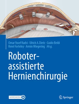 Abbildung von Kudsi / Dietz | Roboterassistierte Hernienchirurgie | 1. Auflage | 2024 | beck-shop.de