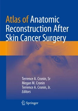 Abbildung von Cronin, Sr / Cronin | Atlas of Anatomic Reconstruction After Skin Cancer Surgery | 1. Auflage | 2024 | beck-shop.de