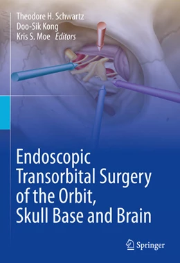 Abbildung von Schwartz / Kong | Endoscopic Transorbital Surgery of the Orbit, Skull Base and Brain | 1. Auflage | 2024 | beck-shop.de