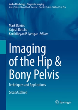 Abbildung von Davies / Botchu | Imaging of the Hip & Bony Pelvis | 2. Auflage | 2024 | beck-shop.de