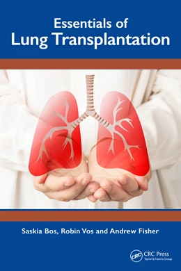 Abbildung von Fisher / Vos | Essentials of Lung Transplantation | 1. Auflage | 2025 | beck-shop.de