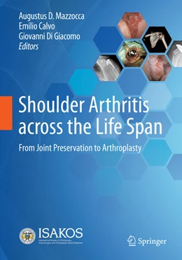 Abbildung von Mazzocca / Di Giacomo | Shoulder Arthritis across the Life Span | 1. Auflage | 2024 | beck-shop.de